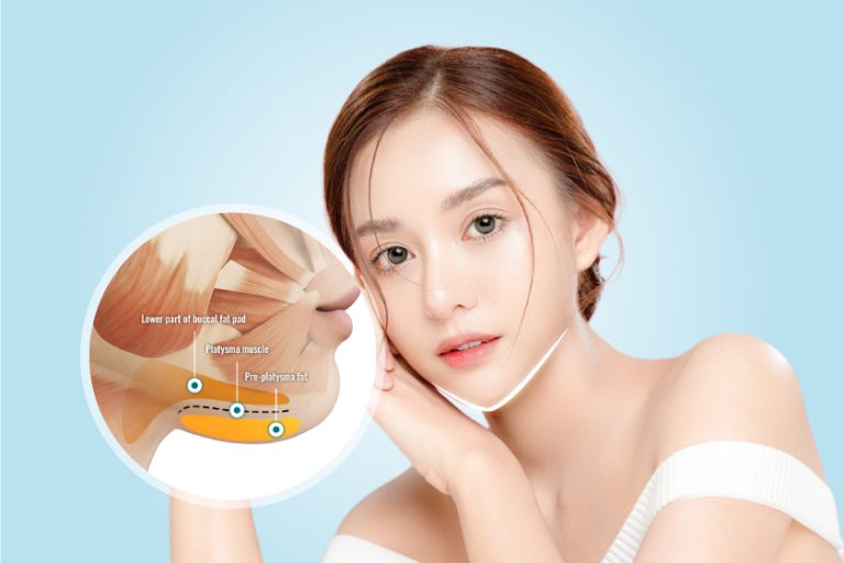 Tạo hình thẩm mỹ vùng hàm mặt - drdinhphuong.com