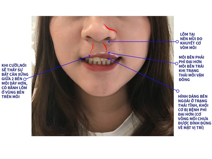 Người phụ nữ U40 và hành trình tìm lại nụ cười trọn vẹn 