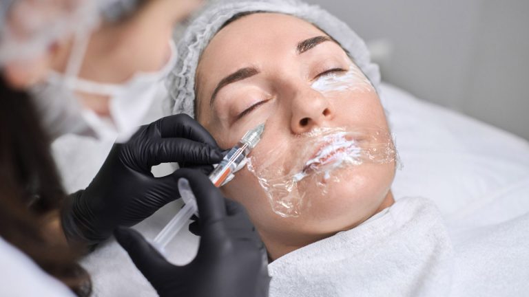 Cấy mỡ mặt trẻ hóa da