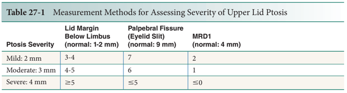 Xác định phân độ sụp mí mắt dựa trên khoảng cách từ bờ mi đến đồng tử mắt 