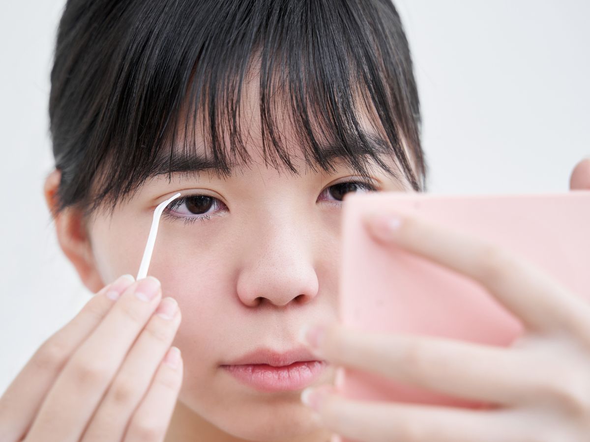 Trường hợp nên phẫu thuật mí mắt