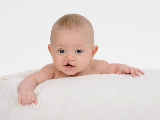 Nguyên nhân gây tình trạng khe hở môi ở trẻ