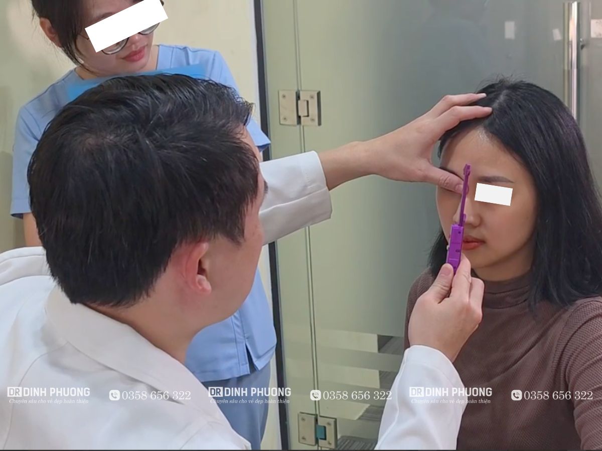 Bác sĩ thực hiện đo vẽ chi tiết để xác định các điểm cần điều chỉnh trước phẫu thuật