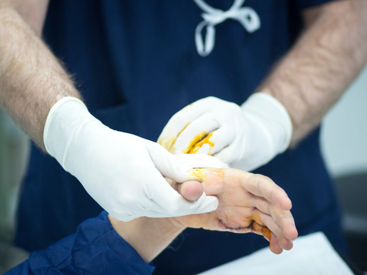 Phẫu thuật là biện pháp điều trị chính để cải thiện dị tật thiếu ngón 