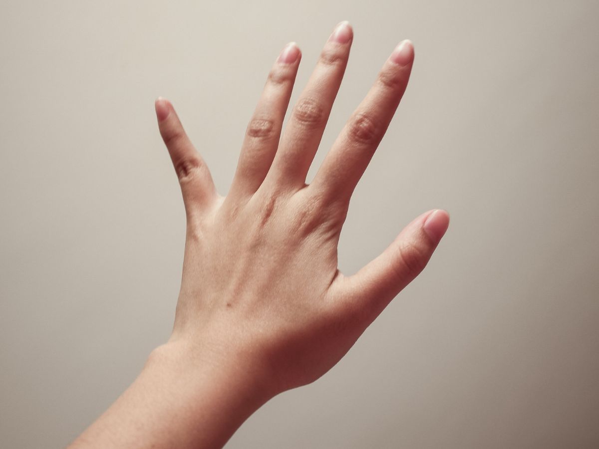 Dị tật chi hiện không thể chữa khỏi hoàn toàn theo cấu trúc tự nhiên ban đầu