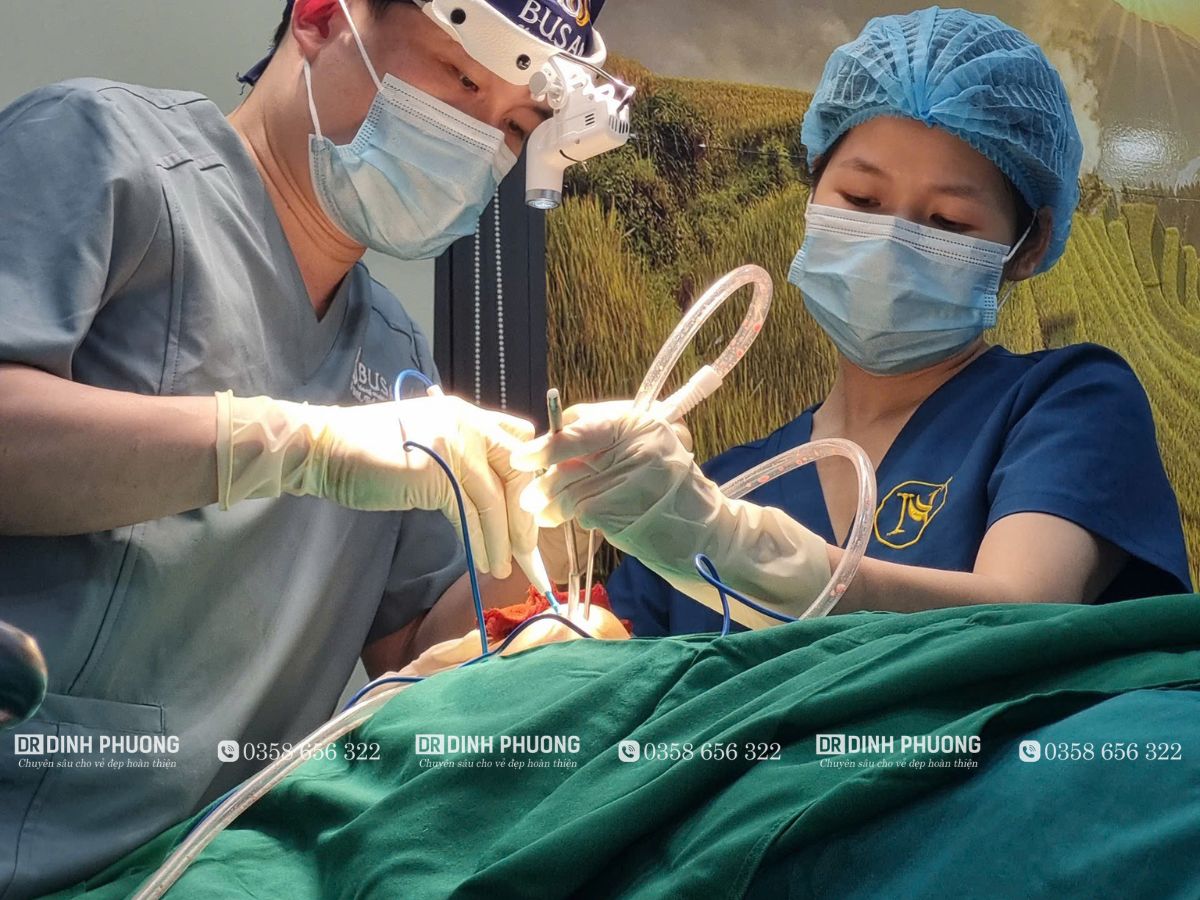 Quá trình thực hiện hút mỡ nọng cằm được bác sĩ Phượng thực hiện nghiêm ngặt chuẩn Y khoa 