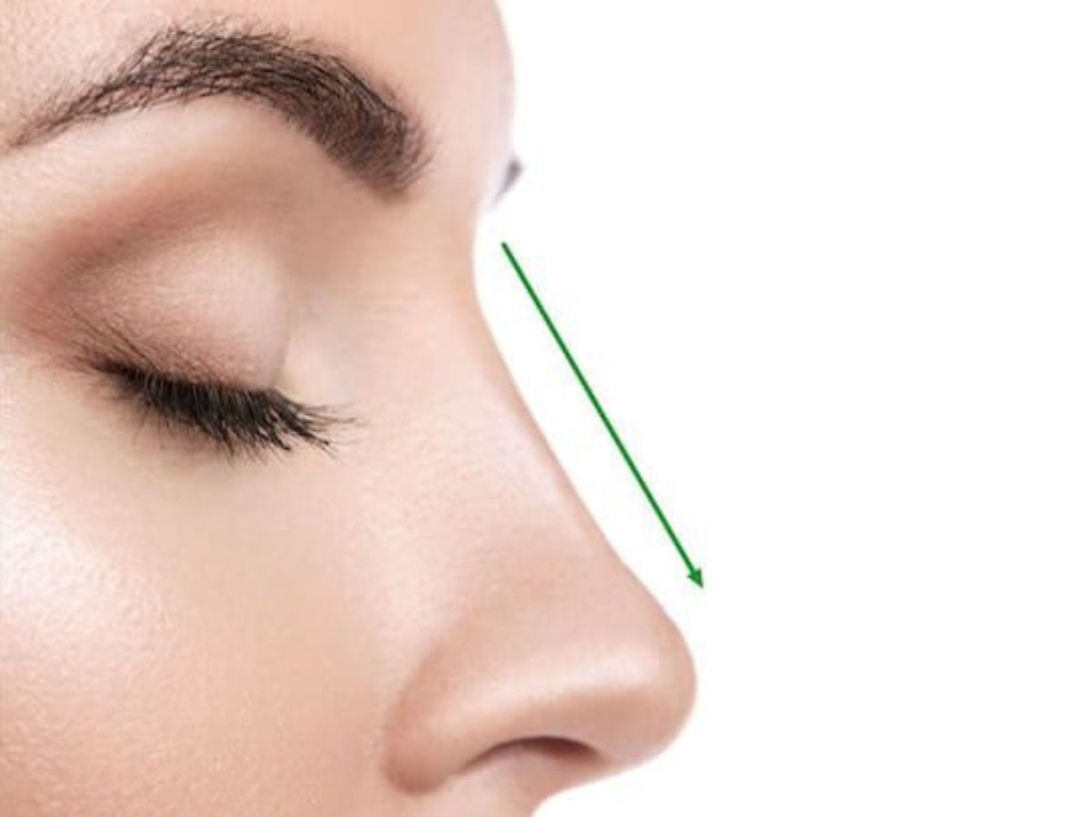 Những lưu ý để chăm sóc, duy trì dáng mũi khi thực hiện nâng mũi cấu trúc