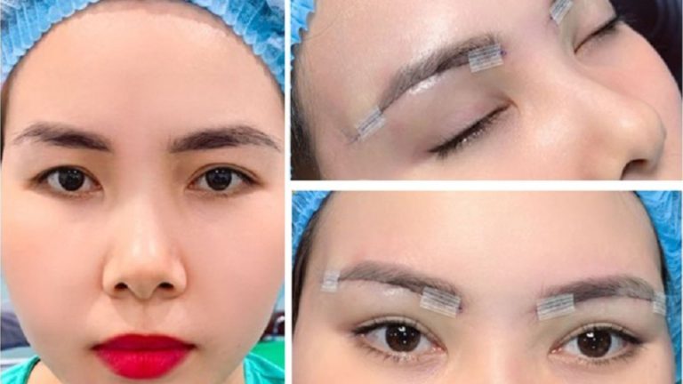 Nâng cung chân mày