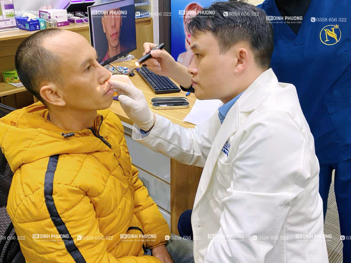 Tại sao cần tạo hình thẩm mỹ môi sau phẫu thuật khe hở môi