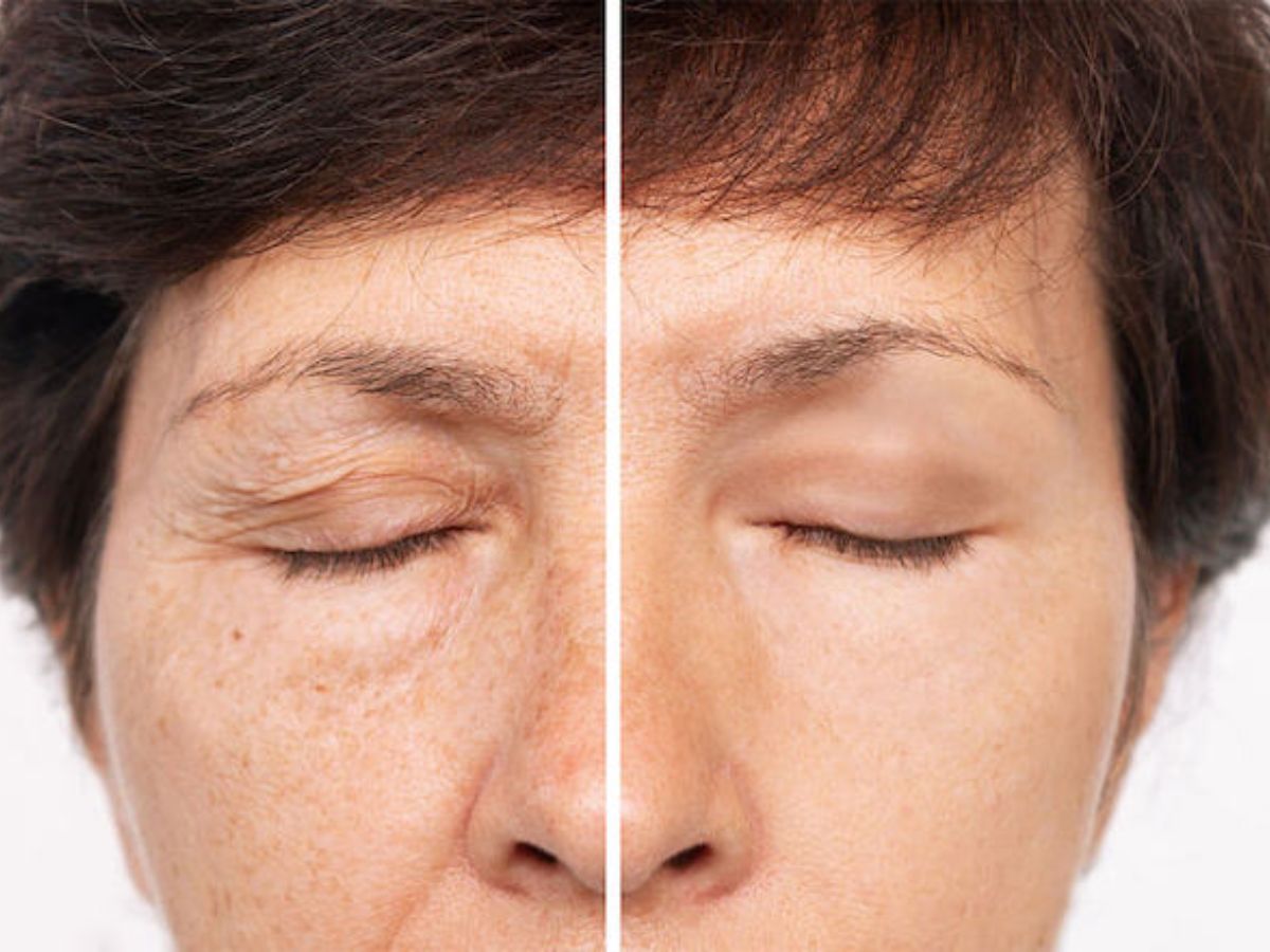 Ai nên và không nên nâng cung chân mày?