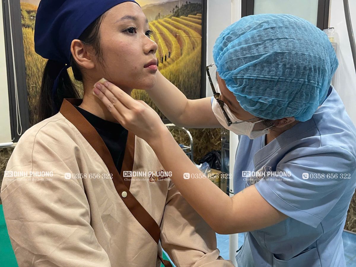 Hình ảnh thăm khám trước khi thực hiện thu gọn cánh mũi