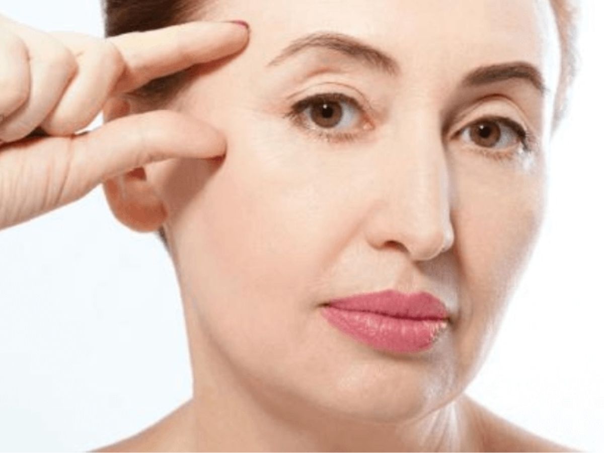 Hình ảnh mắt bị lõm, quầng thâm do lão hóa, mất mô mỡ