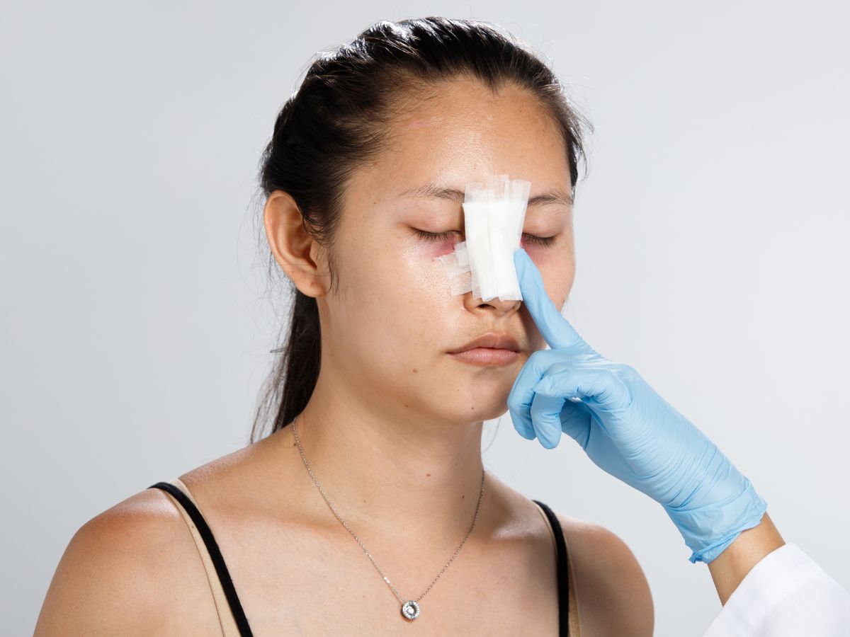 So sánh nâng mũi thẩm mỹ với phẫu thuật tạo hình mũi điều trị