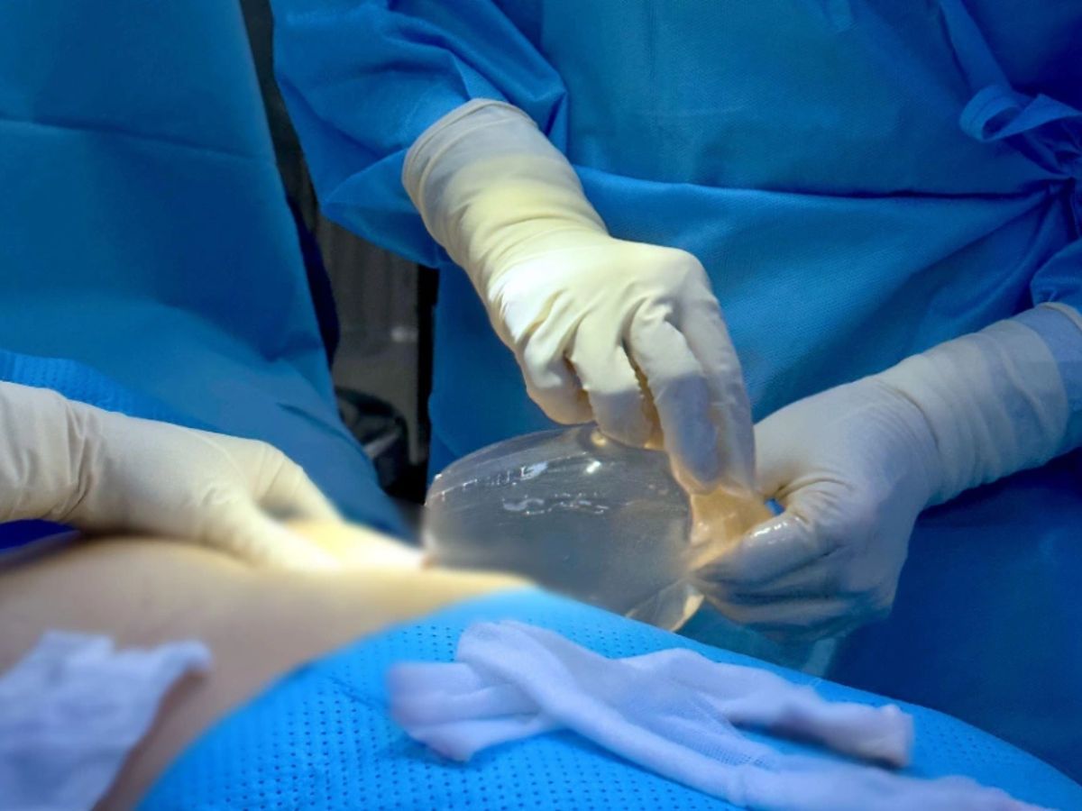 Tìm hiểu về tháo túi ngực