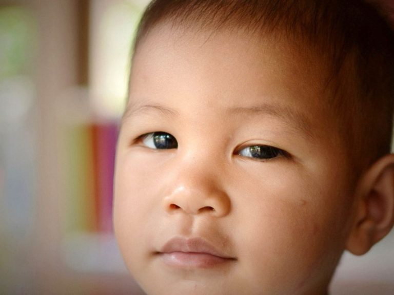 Sụp mí bẩm sinh