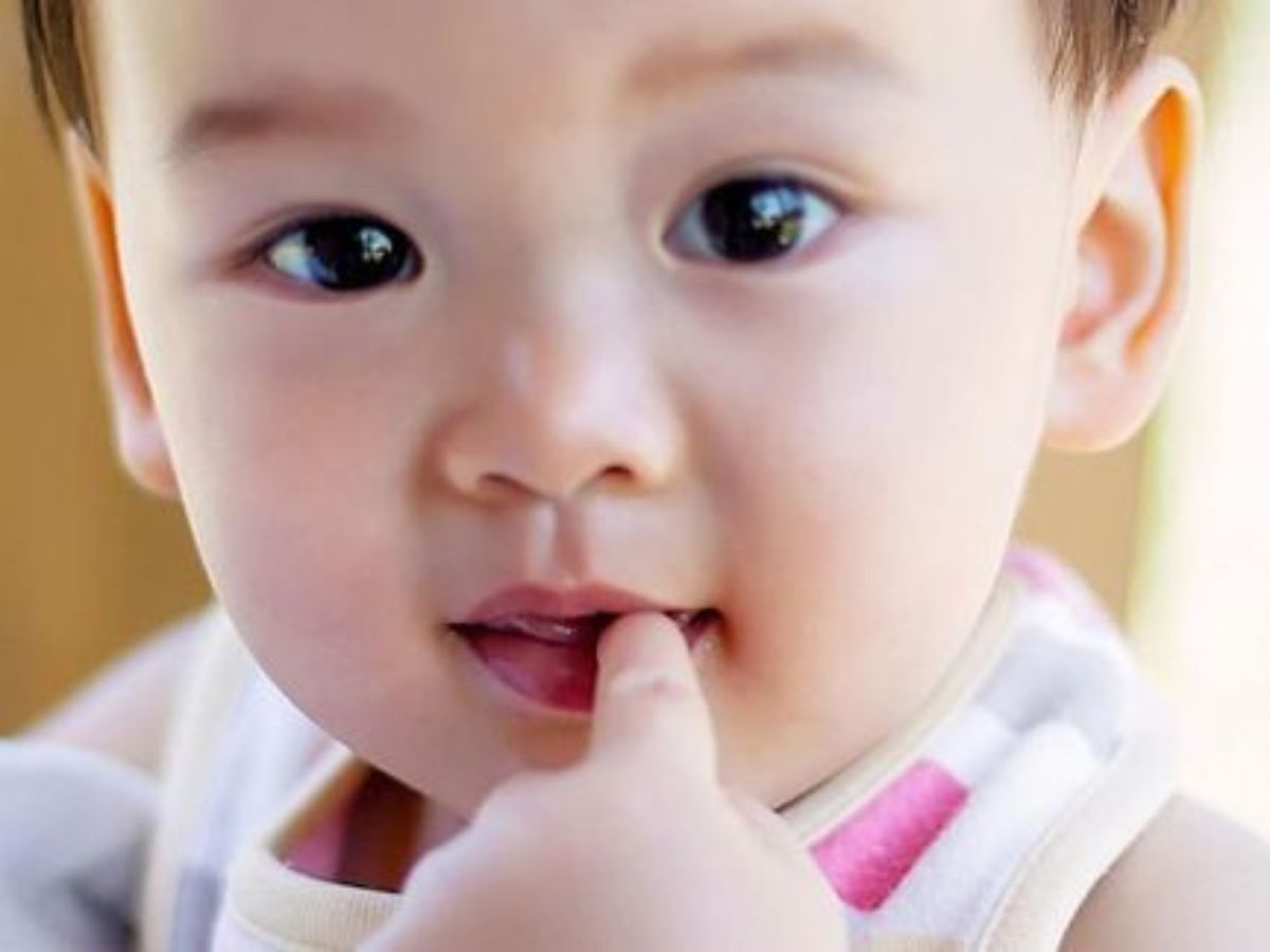 Nguyên nhân gây ra di chứng thông mũi miệng sau phẫu thuật khe hở môi vòm