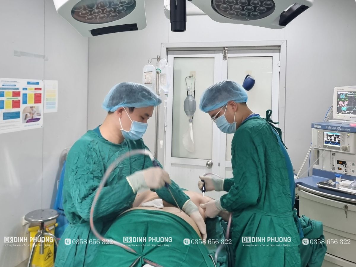 Bác sĩ Trần Đình Phượng thực hiện hút mỡ bụng cho khách hàng 