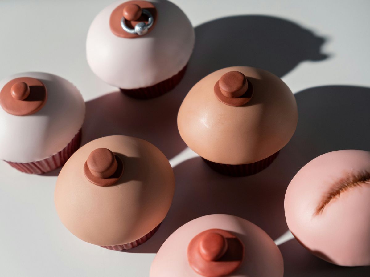 Những thắc mắc thường gặp về phẫu thuật tạo hình nhũ hoa