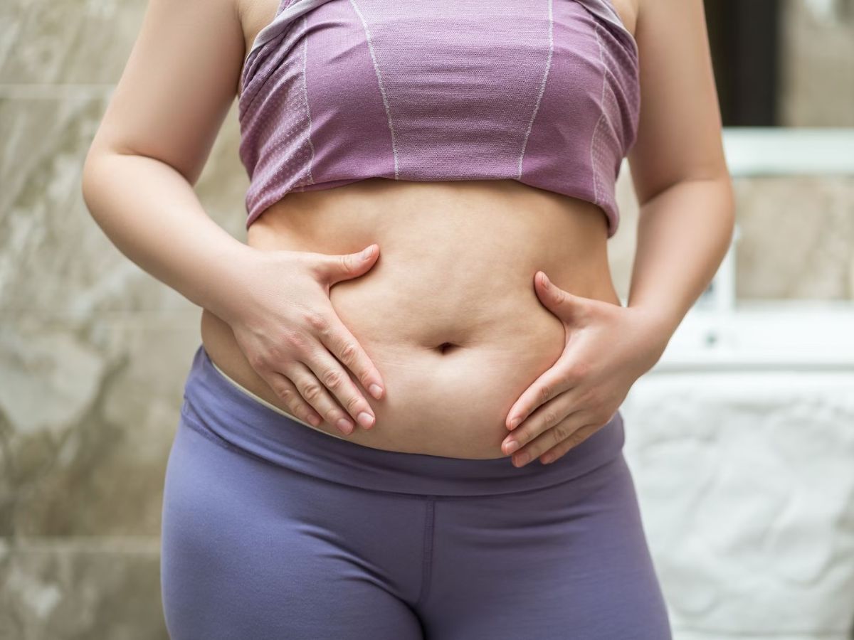 Những ai nên áp dụng phương pháp tạo hình thành bụng?