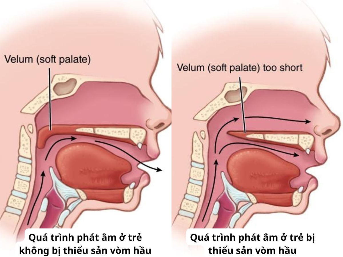 Ảnh mô tả quá trình phát âm