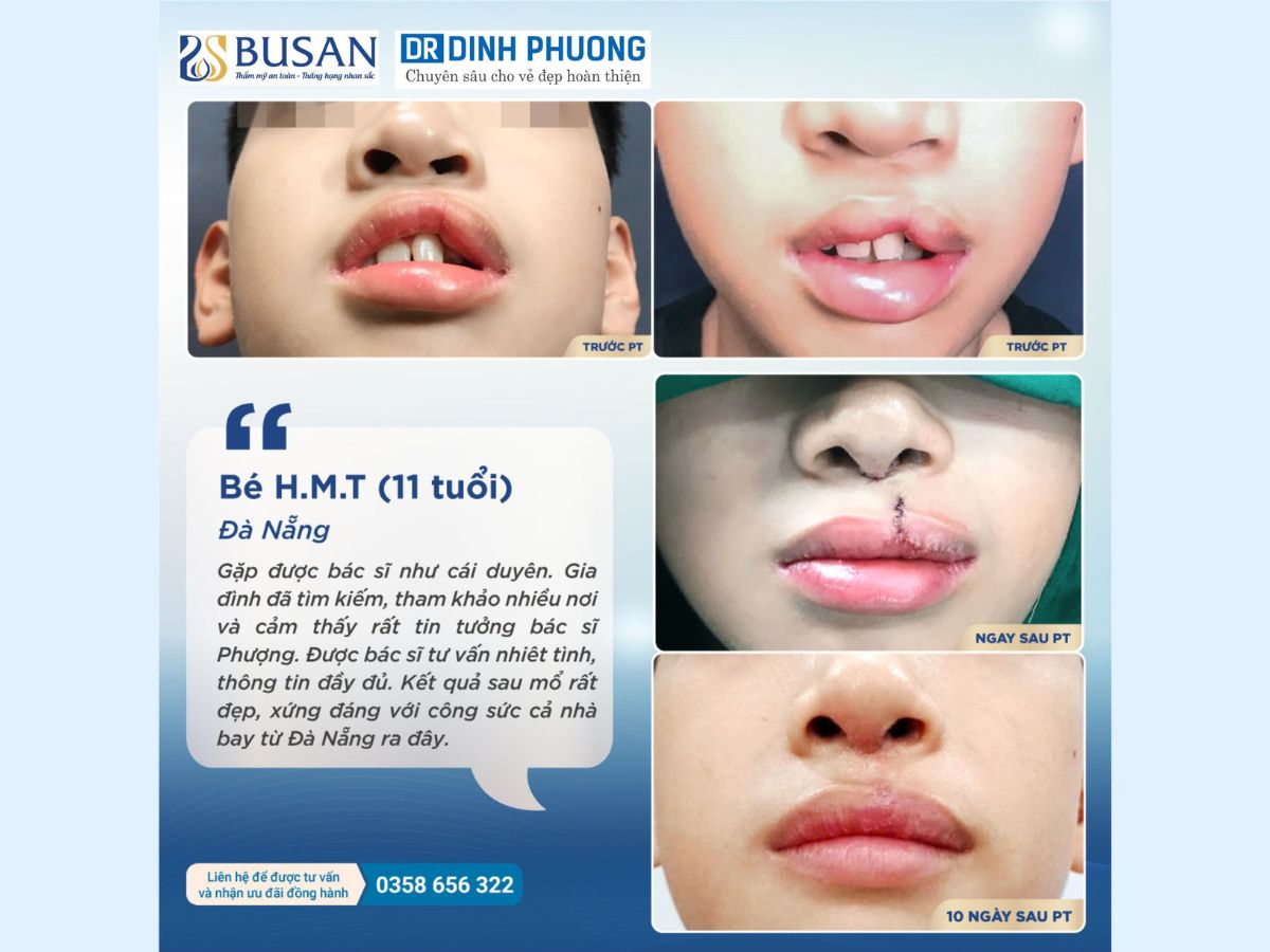 Chia sẻ của khách hàng về bác sĩ Trần Đình Phượng