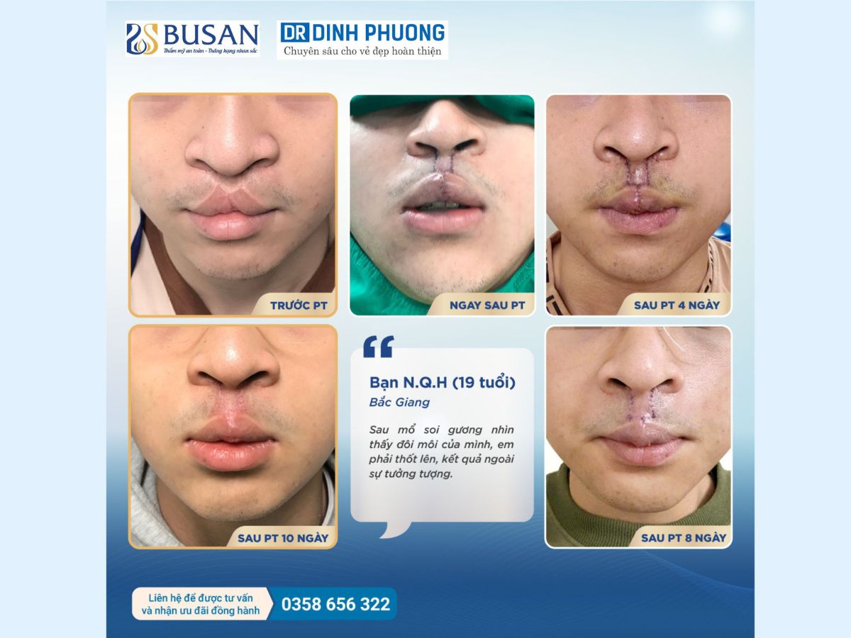 Chia sẻ của khách hàng về bác sĩ Trần Đình Phượng