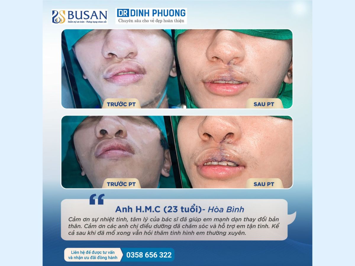 Chia sẻ của khách hàng về bác sĩ Trần Đình Phượng