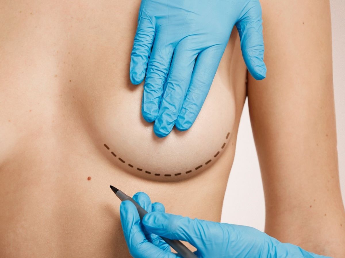 Mức độ an toàn của nâng ngực và những nguy cơ có thể gặp phải