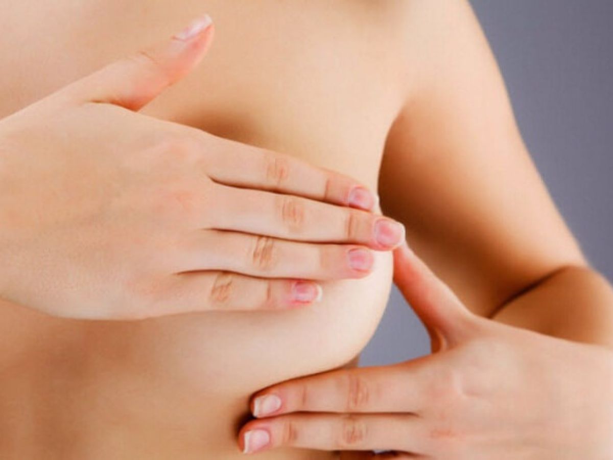 Vì sao quầng ti giãn rộng và cần sự can thiệp từ bác sĩ?